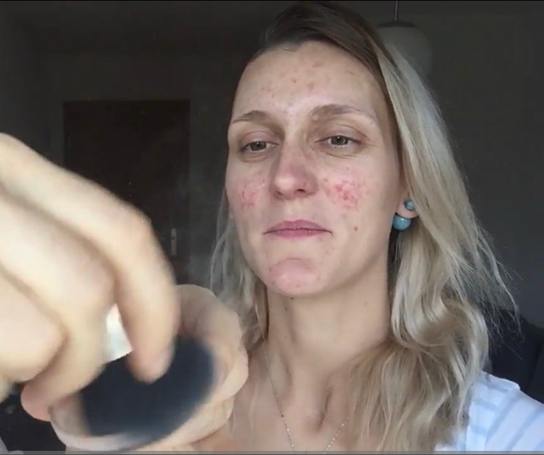 Démo de notre Fond de teint 100% minéral sur Aude qui a une maladie chronique de la peau irréversible